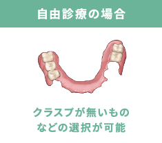 自由診療の場合 クラスプ（留め具）がないものなどの選択が可能