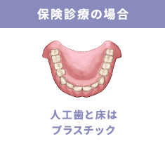 保険診療の場合 人口歯と床はプラスチック