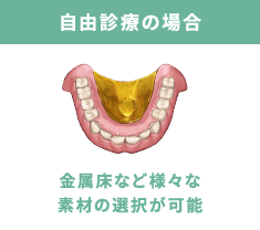 自由診療の場合 金属床などの様々な素材の選択が可能