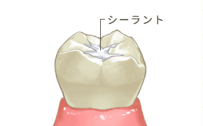 口腔検査・唾液検査